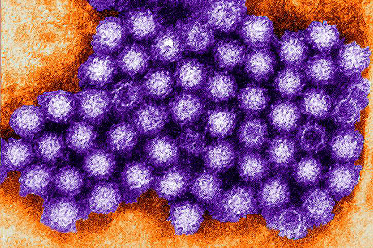 9 ill after potential norovirus outbreak at Bellevue restaurant