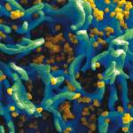 An image showing HIV particles infecting a human T cell (Photo courtesy of the Centers for Disease Control and Prevention).